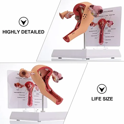 Model anatomii żeńskich narządów rozrodczych - szczegółowe narzędzie do badania patologicznego macicy i jajnika do edukacji medycznej