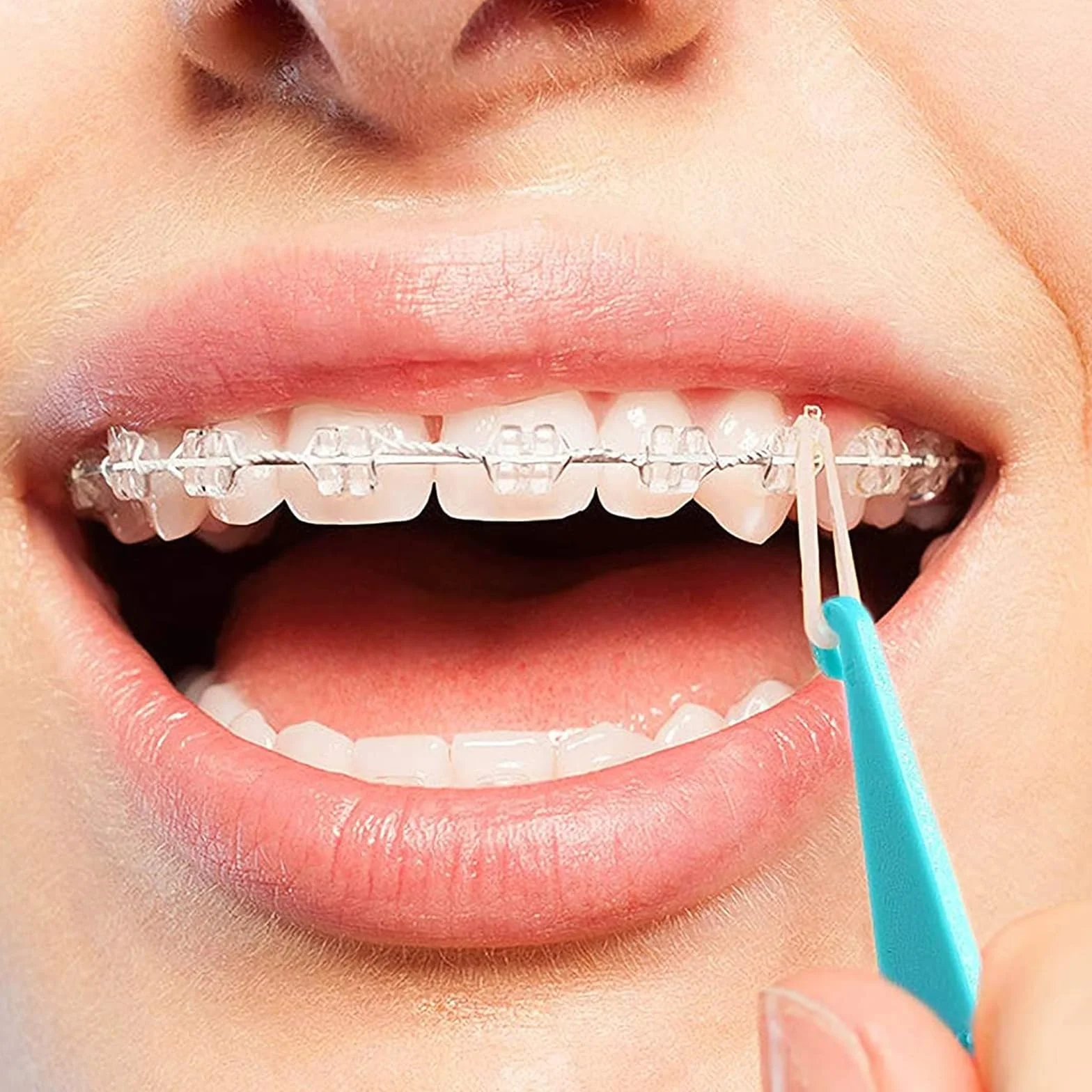 10 szt. Ortodontyczne Plastikowe Jednorazowe Gumowe podpórki do stomatologicznych Gumowe Ochraniacze Na Ortodontyczne, Wielokolorowe