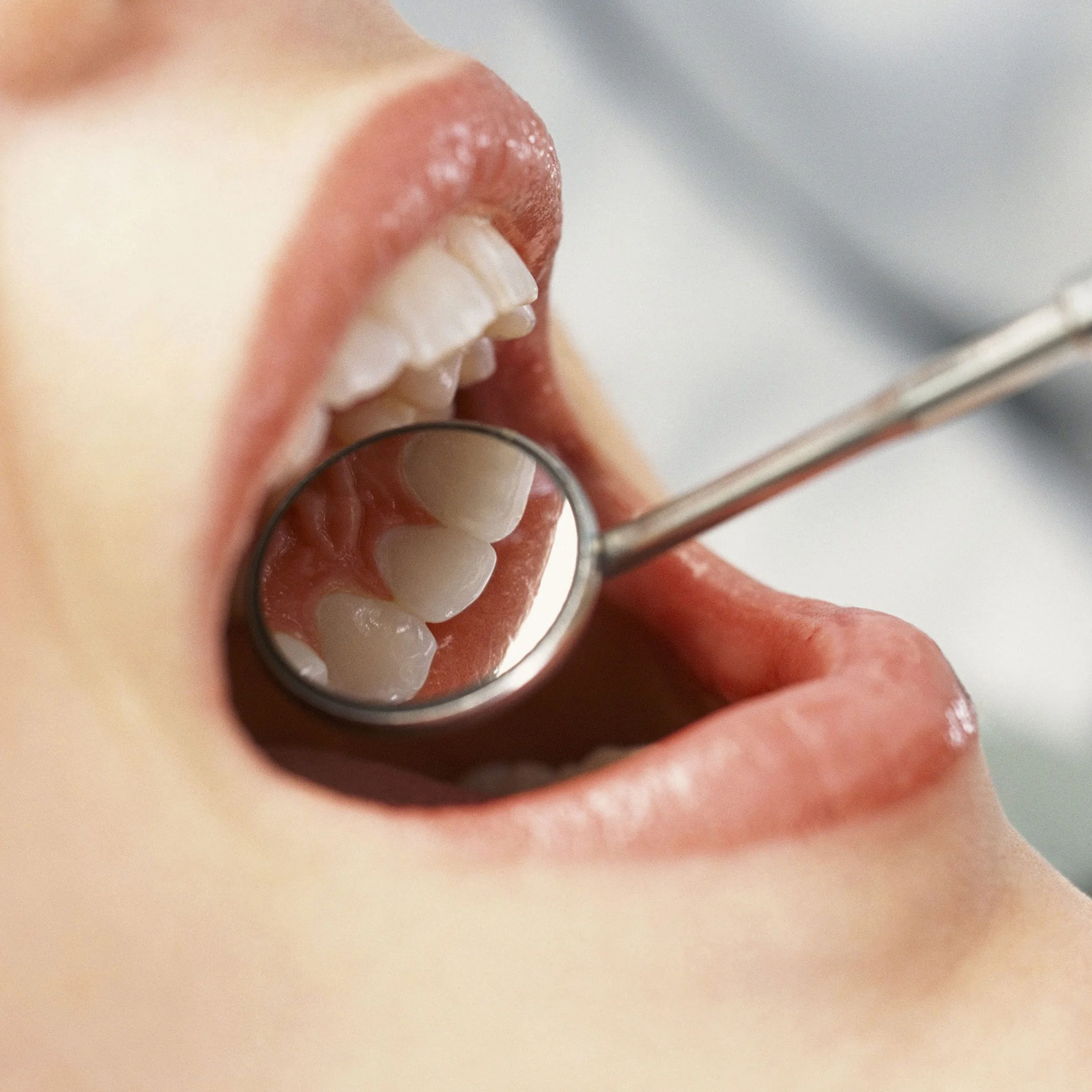 Lusterko dentystyczne ze stali nierdzewnej bez zaparowania narzędzie do higieny jamy ustnej
