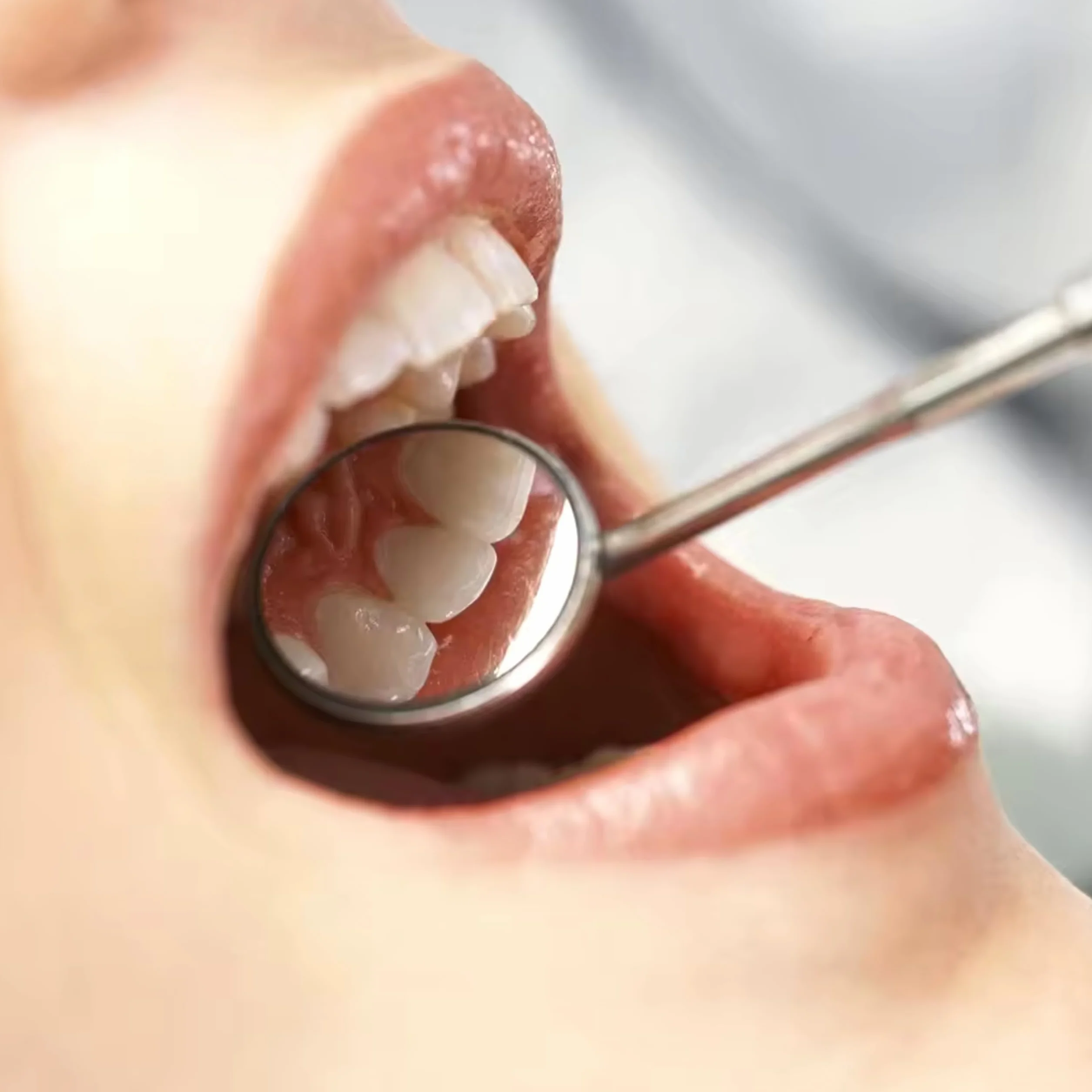 PROFESJONALNE LUSTERKO STOMATOLOGICZNE DENTYSTYCZNE POWIĘKSZAJĄCE DO ZĘBÓW