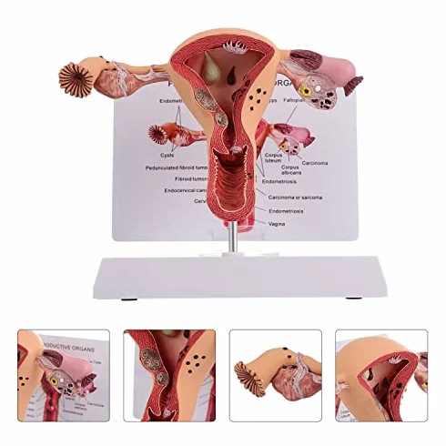 Model anatomii żeńskich narządów rozrodczych - szczegółowe narzędzie do badania patologicznego macicy i jajnika do edukacji medycznej