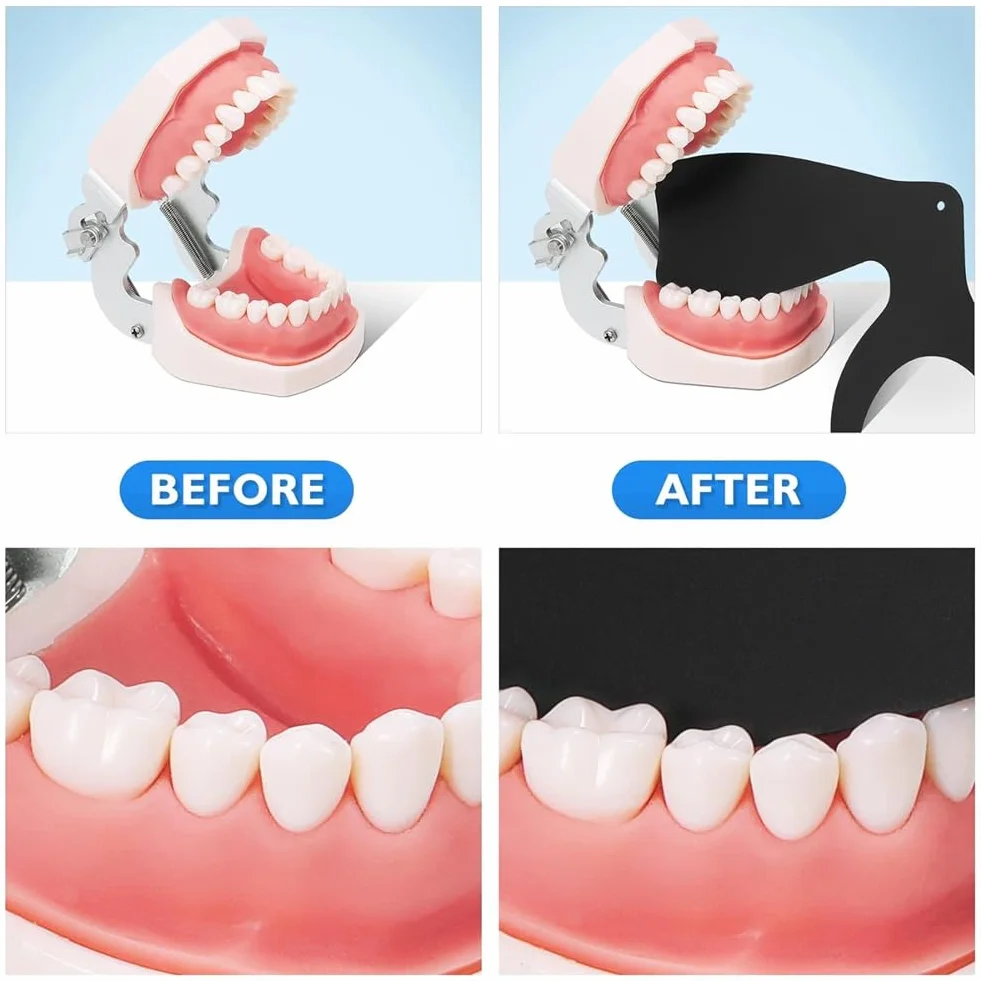 Dental Contraster Intraoral Photographic, zestaw do fotografii wewnątrzustnej, 6