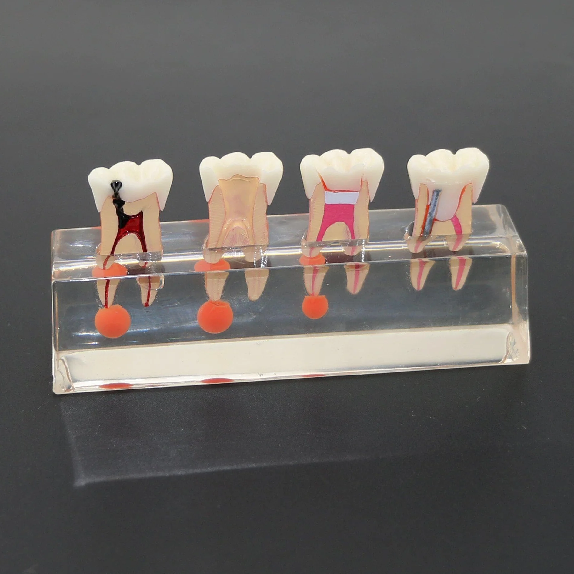Model zębów dentystycznych leczenie endodontyczne przezroczysty demonstruje model nauczania stomatologicznego model do nauki nauczania edukacji pacjenta