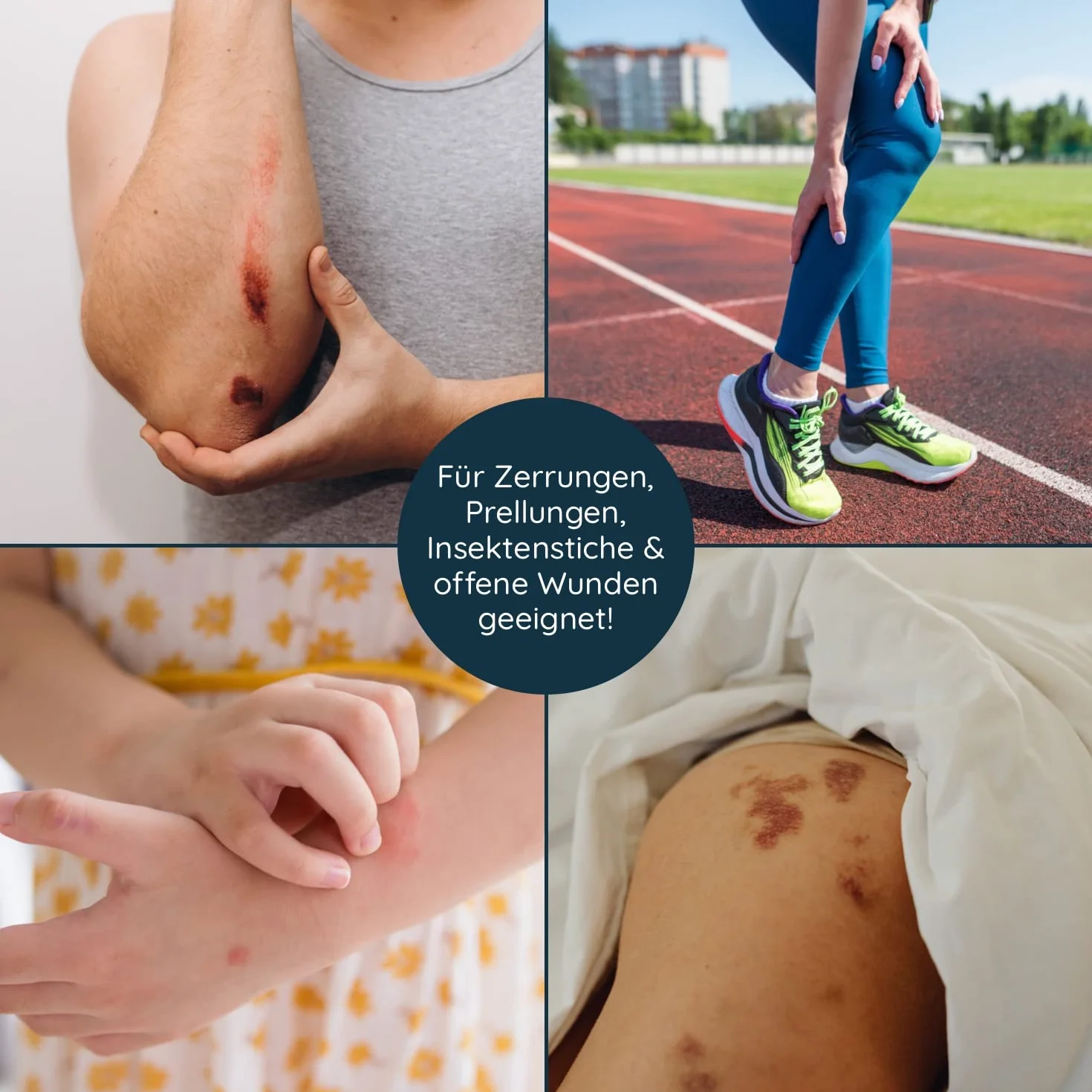 Spray na rany 75 ml do czyszczenia ran, spray do czyszczenia ran w butelce z rozpylaczem, pielęgnacja skóry, bezzapachowy i bezbarwny do rozpylania