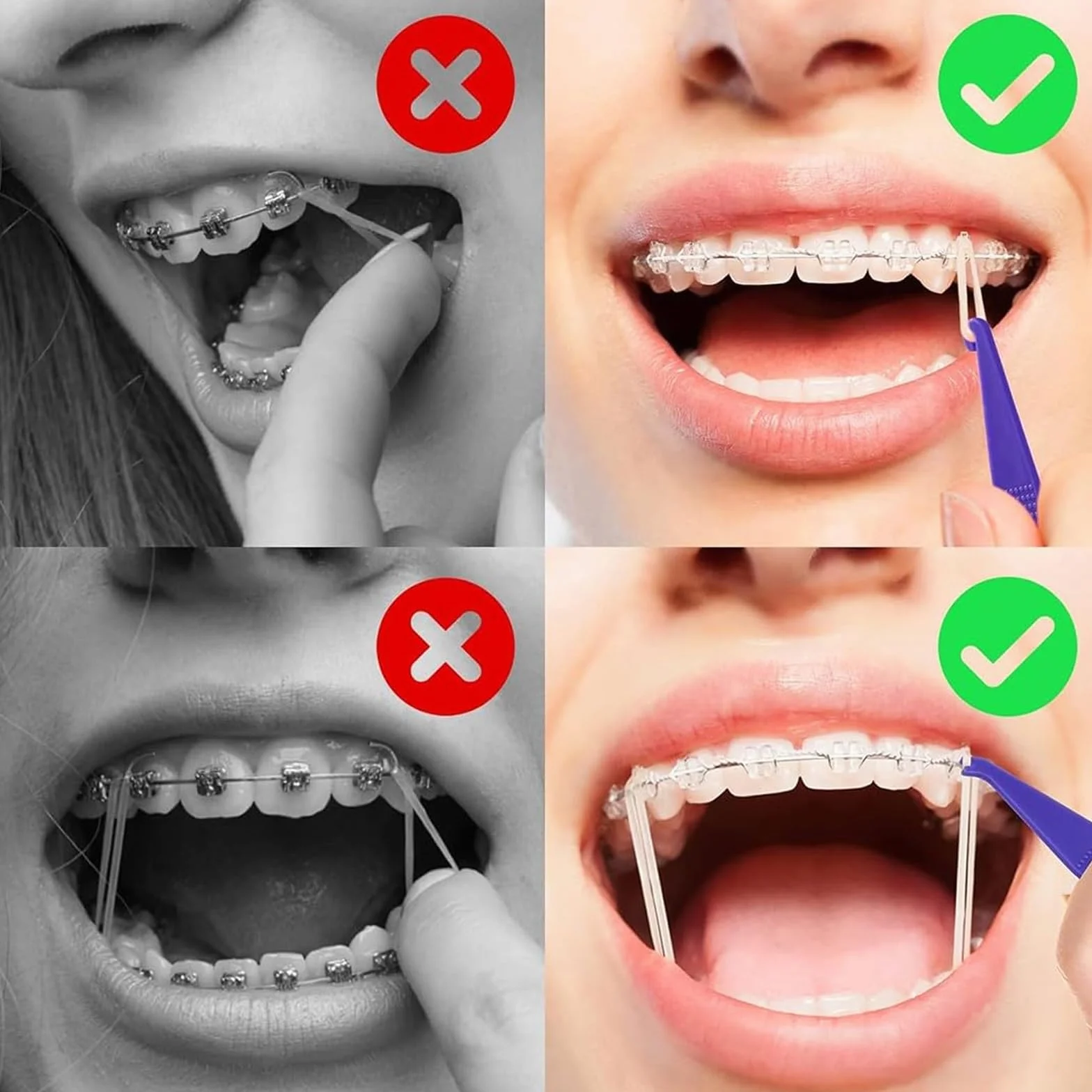 10 szt. Ortodontyczne Plastikowe Jednorazowe Gumowe podpórki do stomatologicznych Gumowe Ochraniacze Na Ortodontyczne, Wielokolorowe