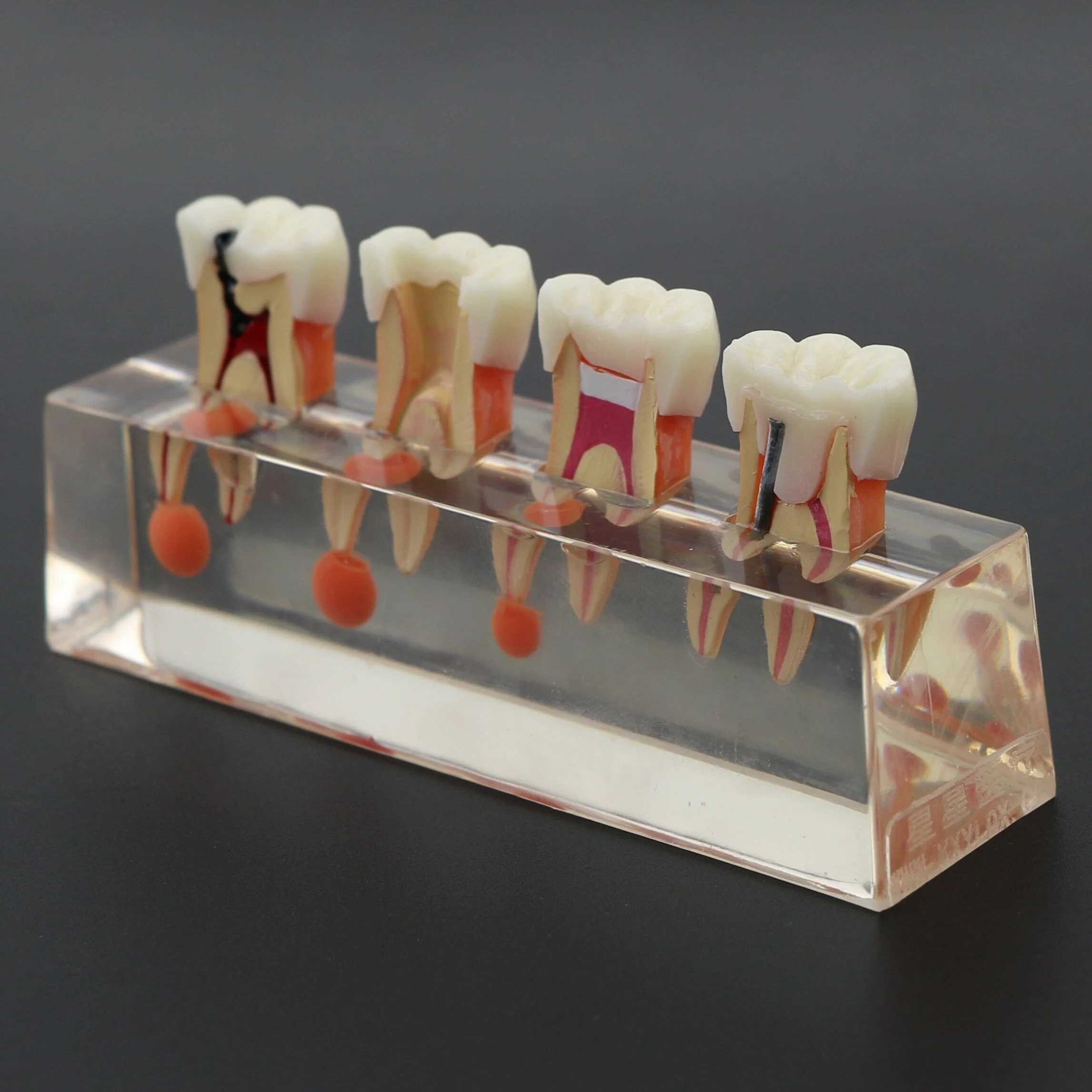Model zębów dentystycznych leczenie endodontyczne przezroczysty demonstruje model nauczania stomatologicznego model do nauki nauczania edukacji pacjenta