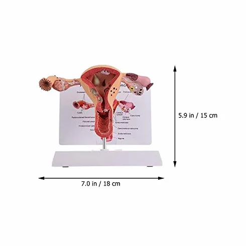Model anatomii żeńskich narządów rozrodczych - szczegółowe narzędzie do badania patologicznego macicy i jajnika do edukacji medycznej