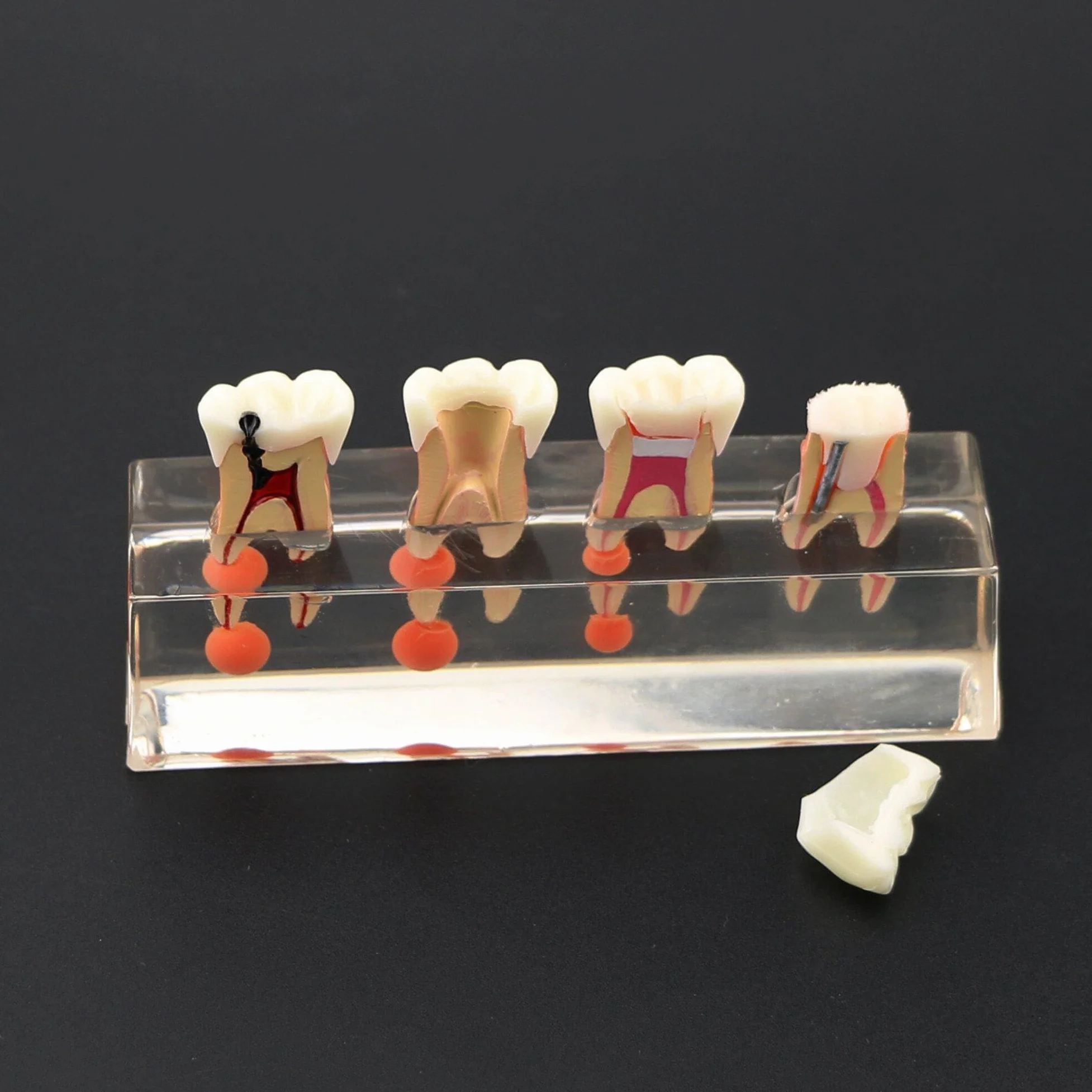 Model zębów dentystycznych leczenie endodontyczne przezroczysty demonstruje model nauczania stomatologicznego model do nauki nauczania edukacji pacjenta