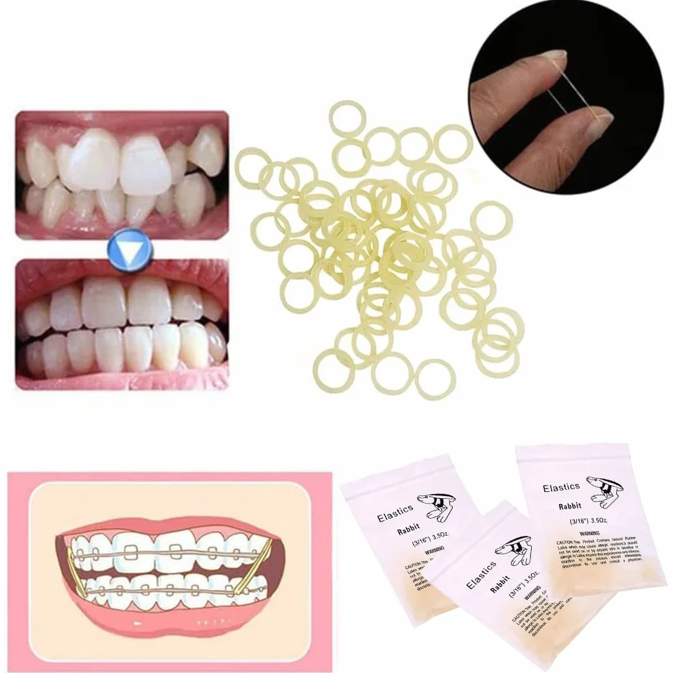 Ortodontyczne gumki gumowe, ortodontyczne luki dentystyczne 3/16 przezroczyste elastyczne taśmy, 300 sztuk uniwersalne, Orthodontics Rubber Band Tool