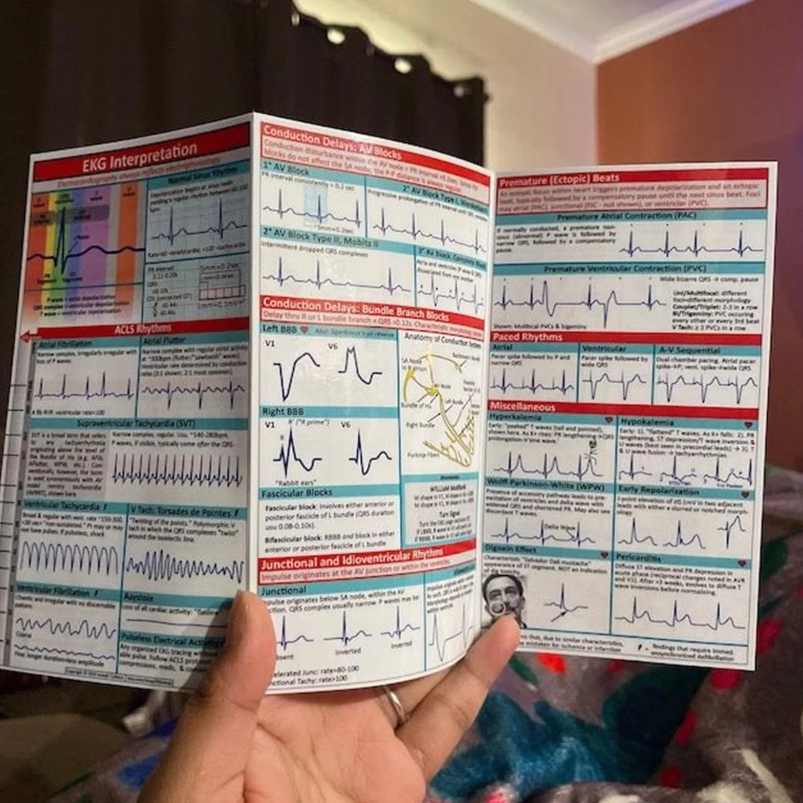 Kieszonkowy przewodnik Ekg, dwustronna, potrójnie składana kieszonkowa analiza rytmu Ekg, medyczna karta referencyjna, łatwa do odczytania, długotrwałe użytkowanie, 30 x 15 cm, dla pielęgniarek i