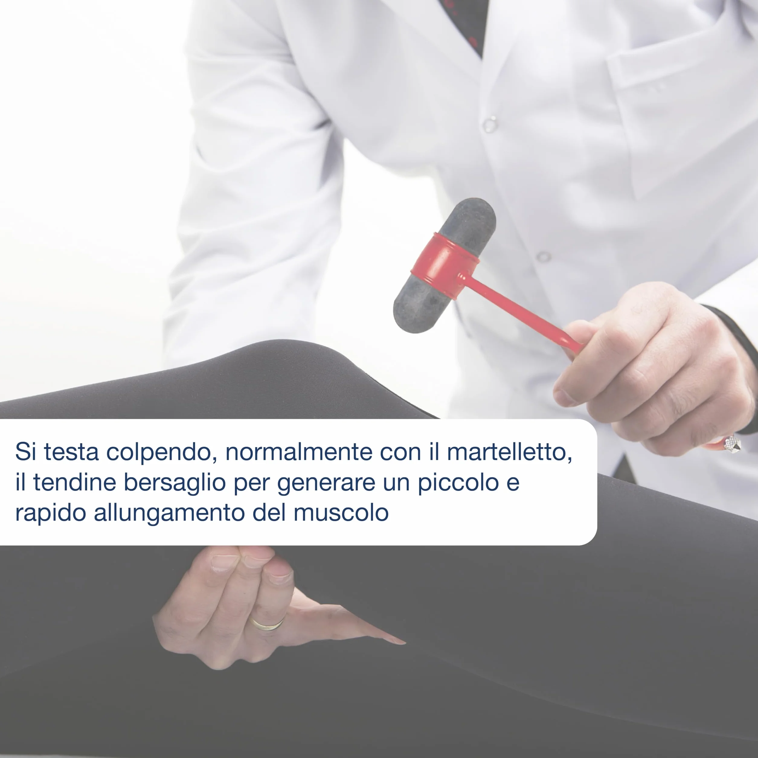 Gima 31255 młotek neurologiczny, kolor Dejerina, 1 sztuka