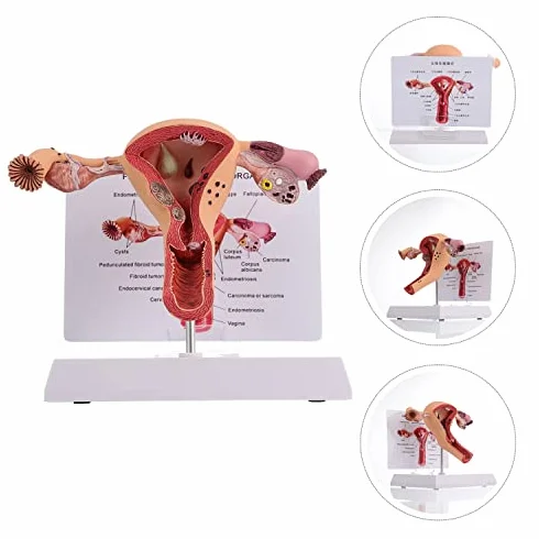 Model anatomii żeńskich narządów rozrodczych - szczegółowe narzędzie do badania patologicznego macicy i jajnika do edukacji medycznej