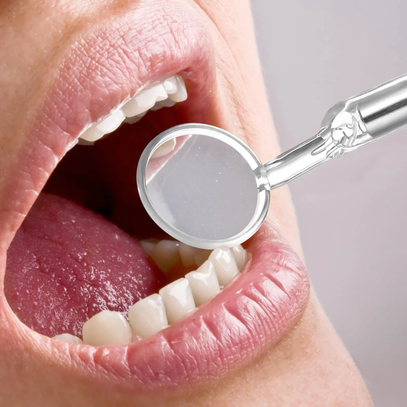 minkissy Lustro Dentystyczne Z Lekkim Narzędziem. Lusterko Inspekcyjne Ze Stali Nierdzewnej Podświetlane Diodami Led. Przeciwmgielne. Kąt Krzywizny. Narzędzie Dentystyczne Do Pielęgnacji