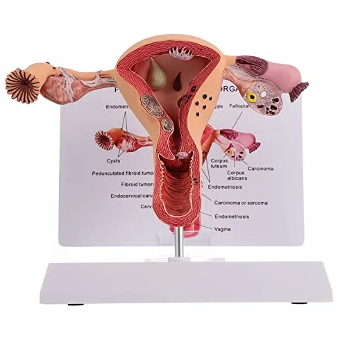 Model anatomii żeńskich narządów rozrodczych - szczegółowe narzędzie do badania patologicznego macicy i jajnika do edukacji medycznej