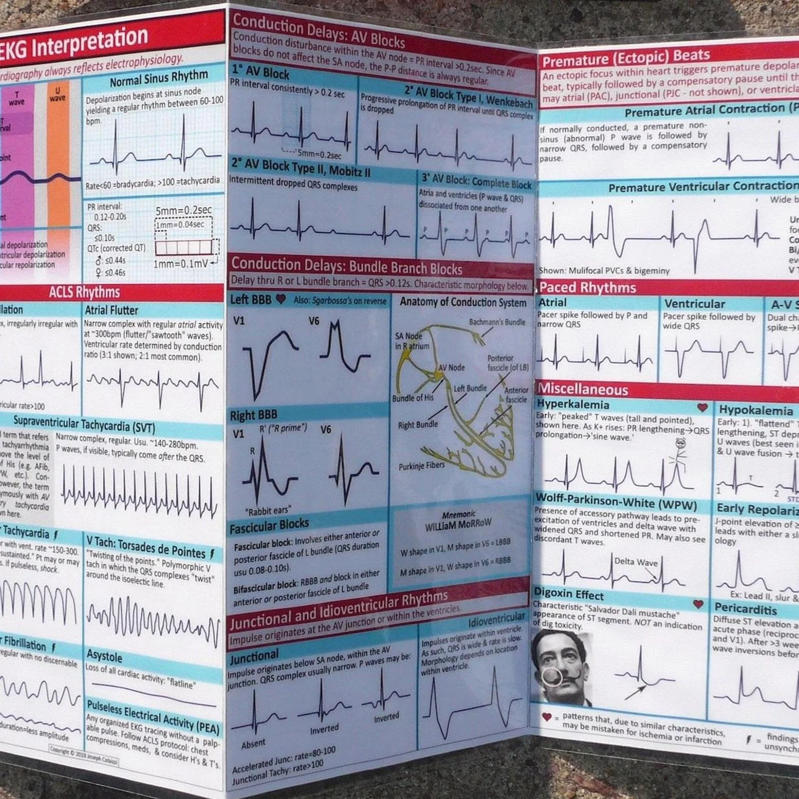 Kieszonkowy przewodnik Ekg, dwustronna, potrójnie składana kieszonkowa analiza rytmu Ekg, medyczna karta referencyjna, łatwa do odczytania, długotrwałe użytkowanie, 30 x 15 cm, dla pielęgniarek i